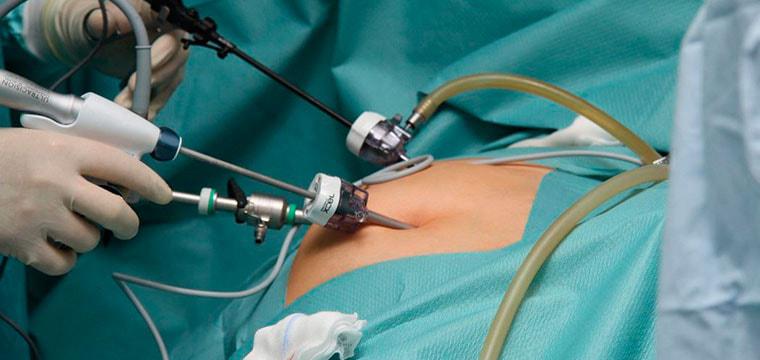 Визуализация раздела Гидронефроз: особенности заболевания почек