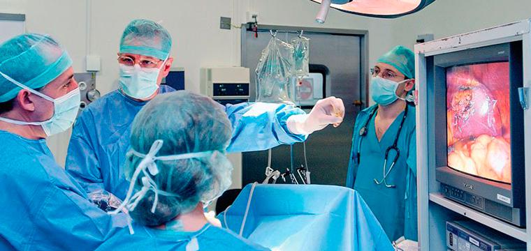 Визуализация раздела Лапароскопическая сальпингэктомия